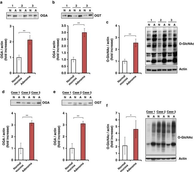 O-linked N-acetylglucosamine (O-GlcNAc) Antibody in Western Blot (WB)