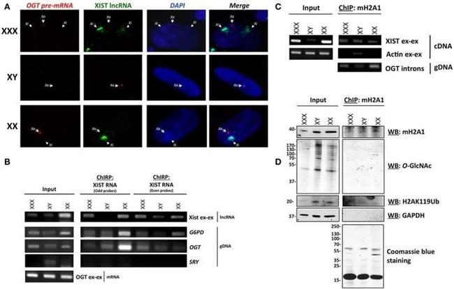 O-linked N-acetylglucosamine (O-GlcNAc) Antibody in Western Blot (WB)