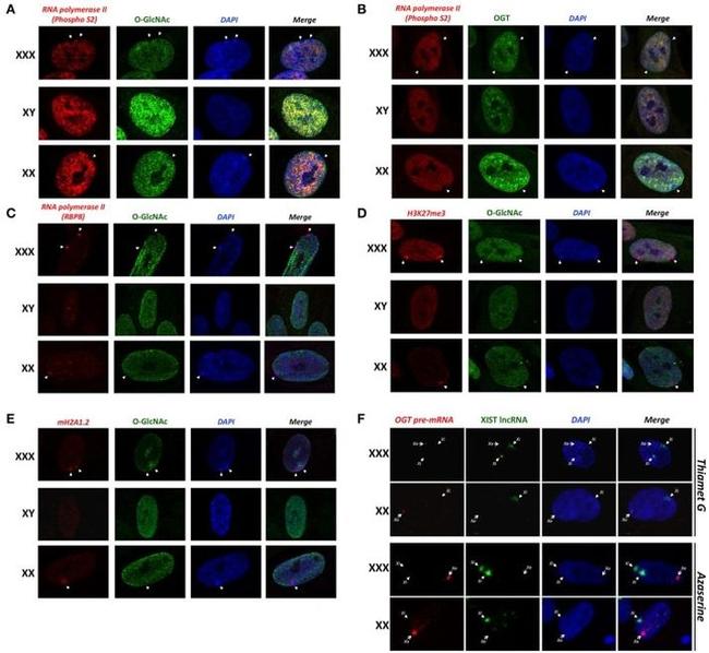 O-linked N-acetylglucosamine (O-GlcNAc) Antibody in Immunocytochemistry (ICC/IF)