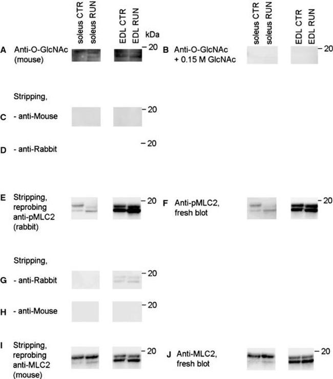 O-linked N-acetylglucosamine (O-GlcNAc) Antibody in Western Blot (WB)