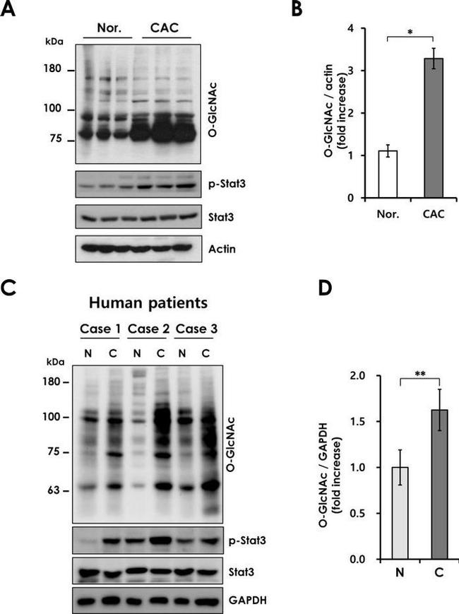 O-linked N-acetylglucosamine (O-GlcNAc) Antibody in Western Blot (WB)