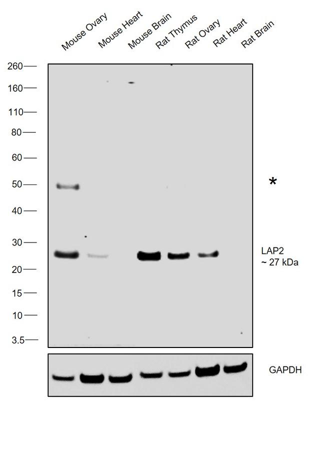 LAP2 Antibody in Western Blot (WB)