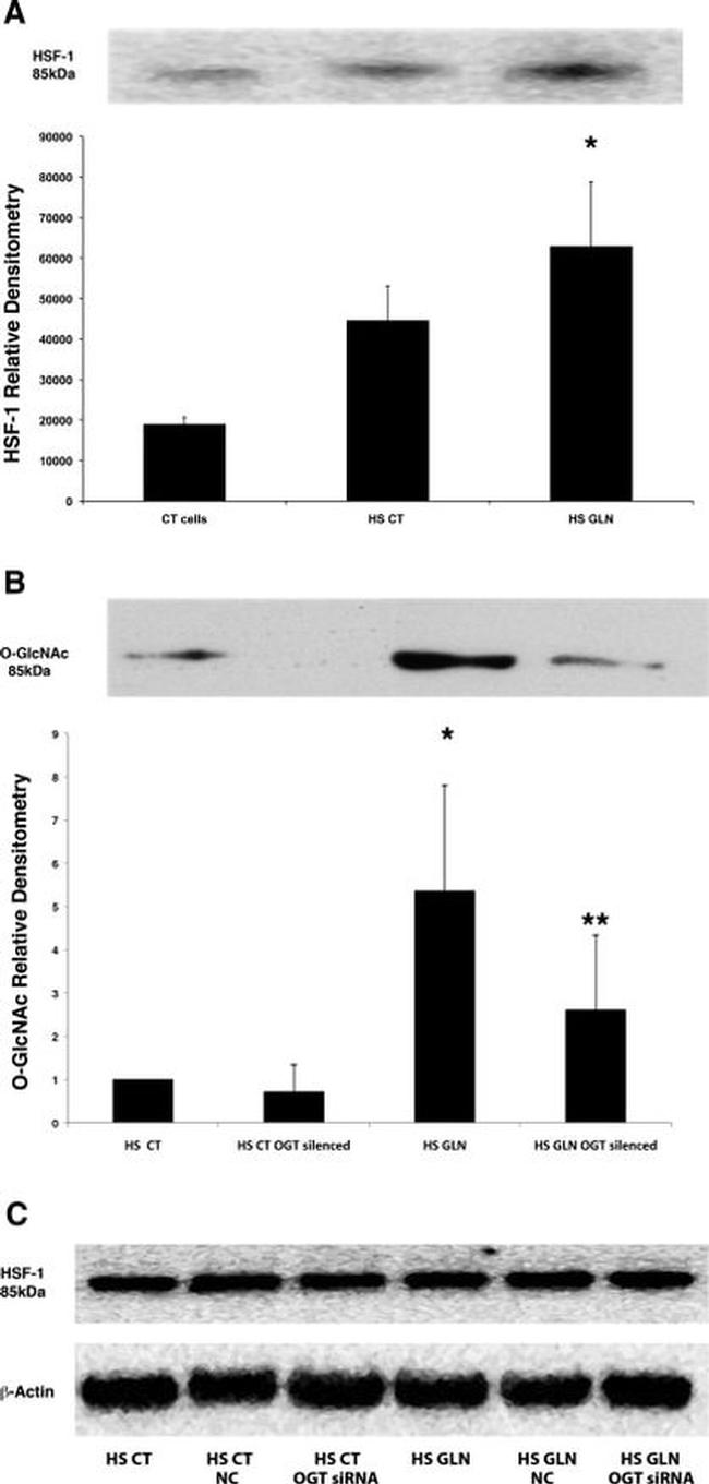 O-linked N-acetylglucosamine (O-GlcNAc) Antibody in Western Blot, Immunoprecipitation (WB, IP)