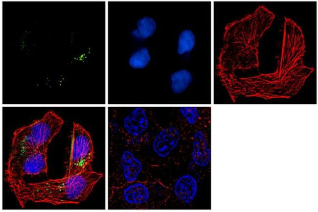 O-linked N-acetylglucosamine (O-GlcNAc) Antibody in Immunocytochemistry (ICC/IF)