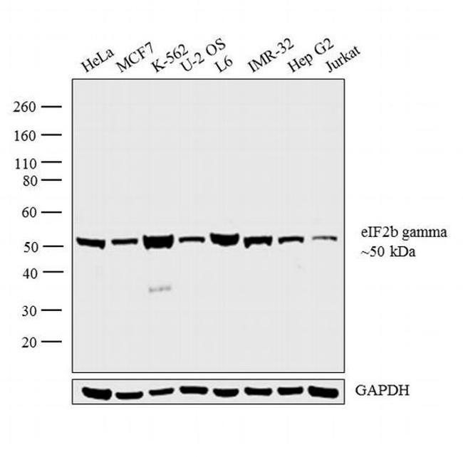 eIF2b gamma Antibody in Western Blot (WB)