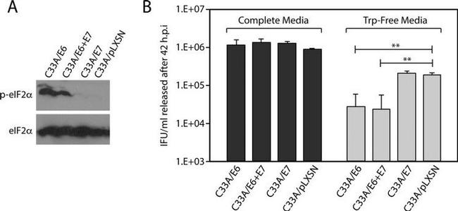 EIF2S1 Antibody in Western Blot (WB)