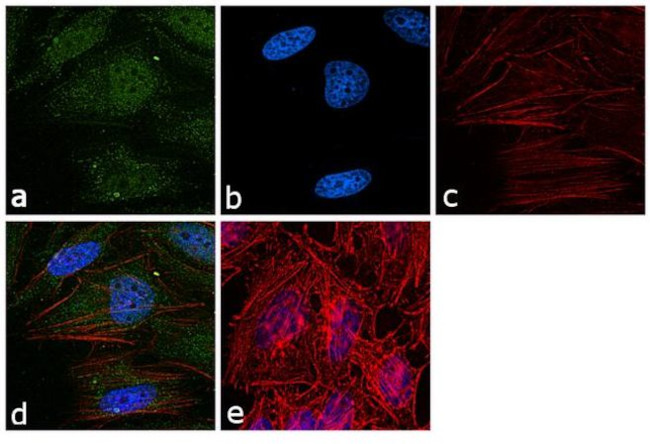 hnRNP K Antibody in Immunocytochemistry (ICC/IF)