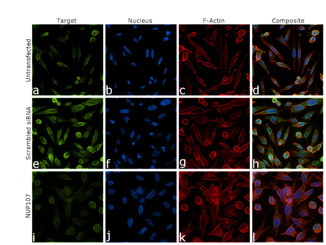 NUP107 Antibody in Immunocytochemistry (ICC/IF)