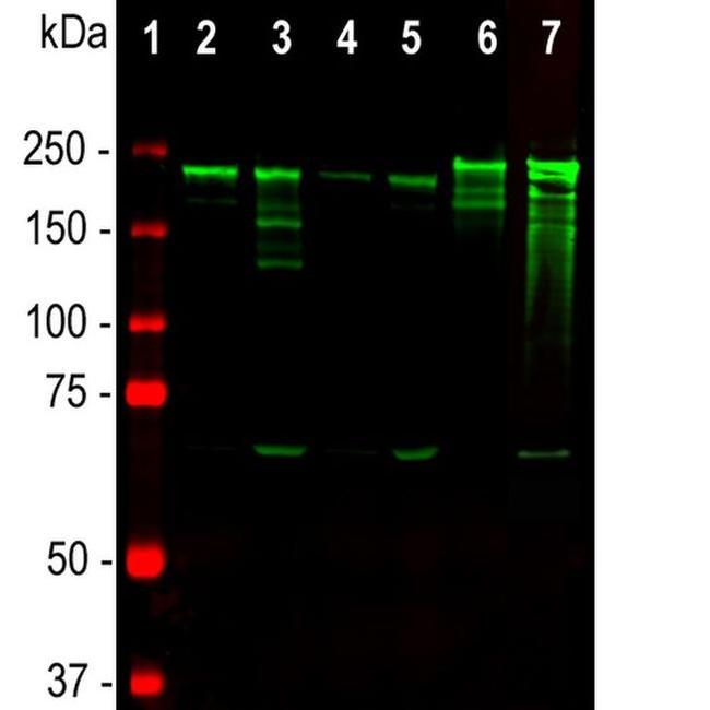 NF-H Antibody in Western Blot (WB)