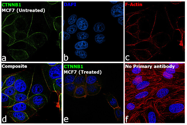 beta Catenin Antibody in Immunocytochemistry (ICC/IF)