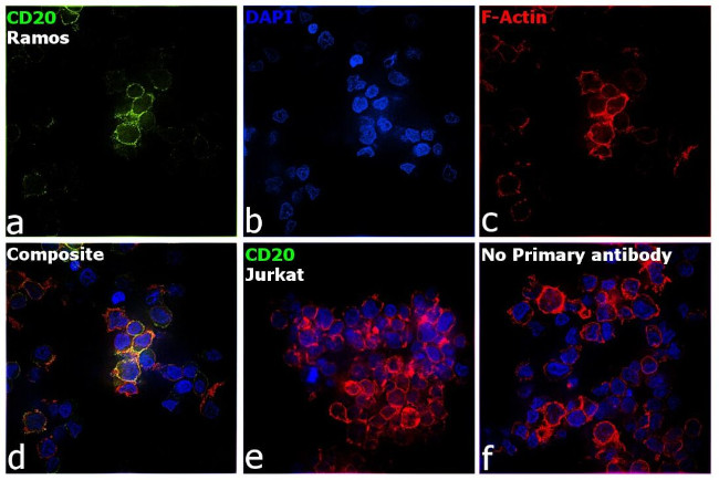 CD20 Antibody in Immunocytochemistry (ICC/IF)