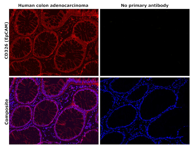 EpCAM Antibody in Immunohistochemistry (Paraffin) (IHC (P))