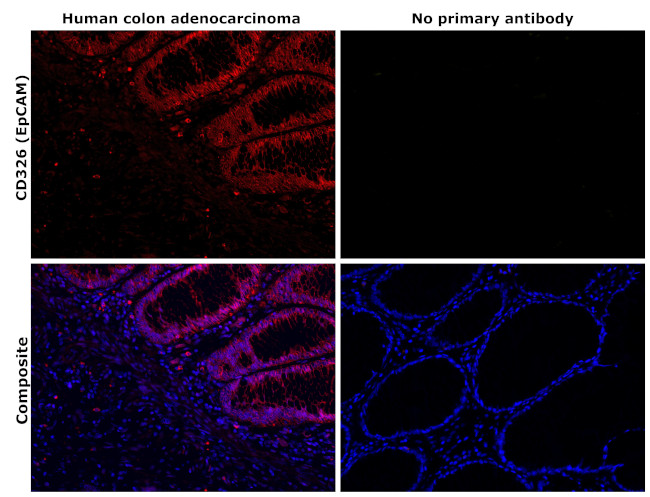 EpCAM Antibody in Immunohistochemistry (Paraffin) (IHC (P))