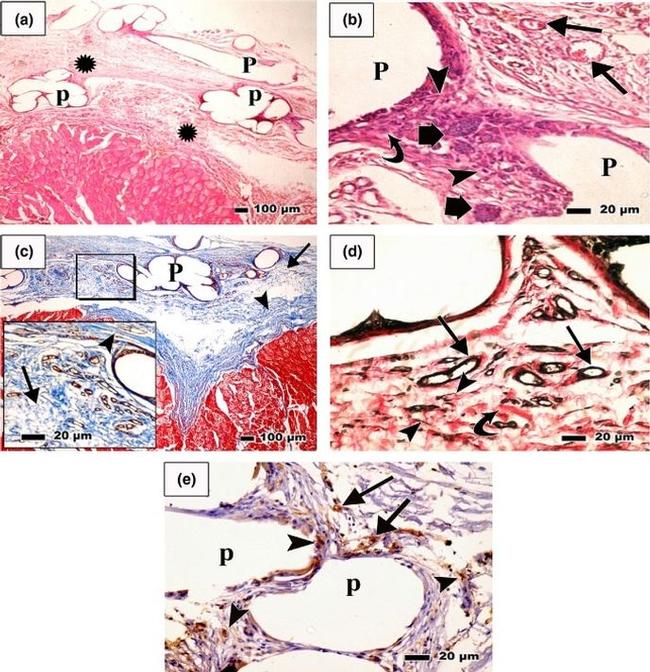 CD34 Antibody in Immunohistochemistry (IHC)