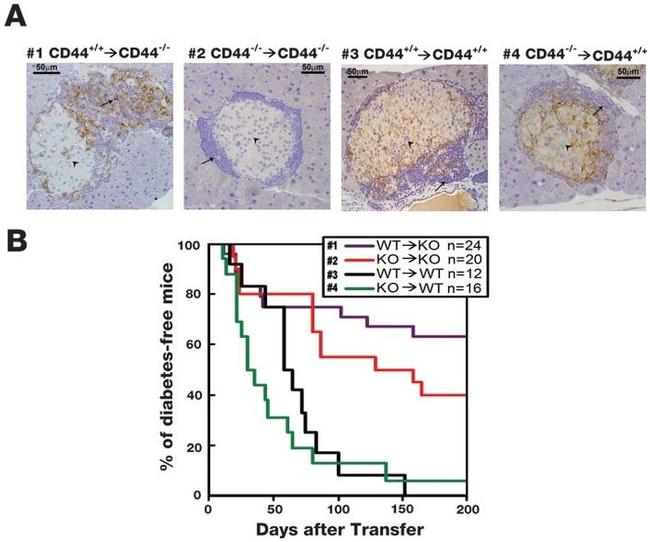 CD44 Antibody in Immunohistochemistry (IHC)