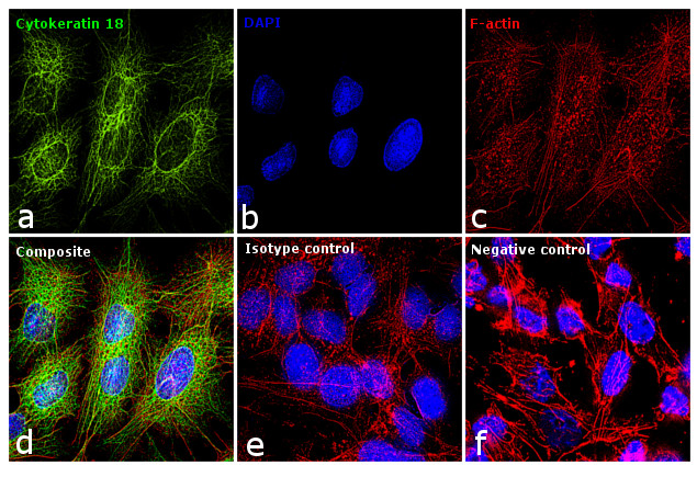 Cytokeratin 18 Antibody