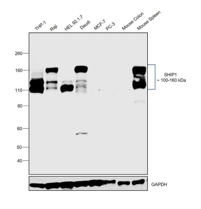 SHIP1 Antibody in Western Blot (WB)