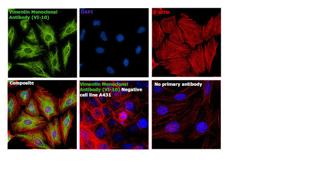 Vimentin Antibody