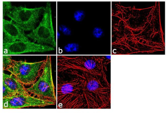 SOD1 Antibody in Immunocytochemistry (ICC/IF)