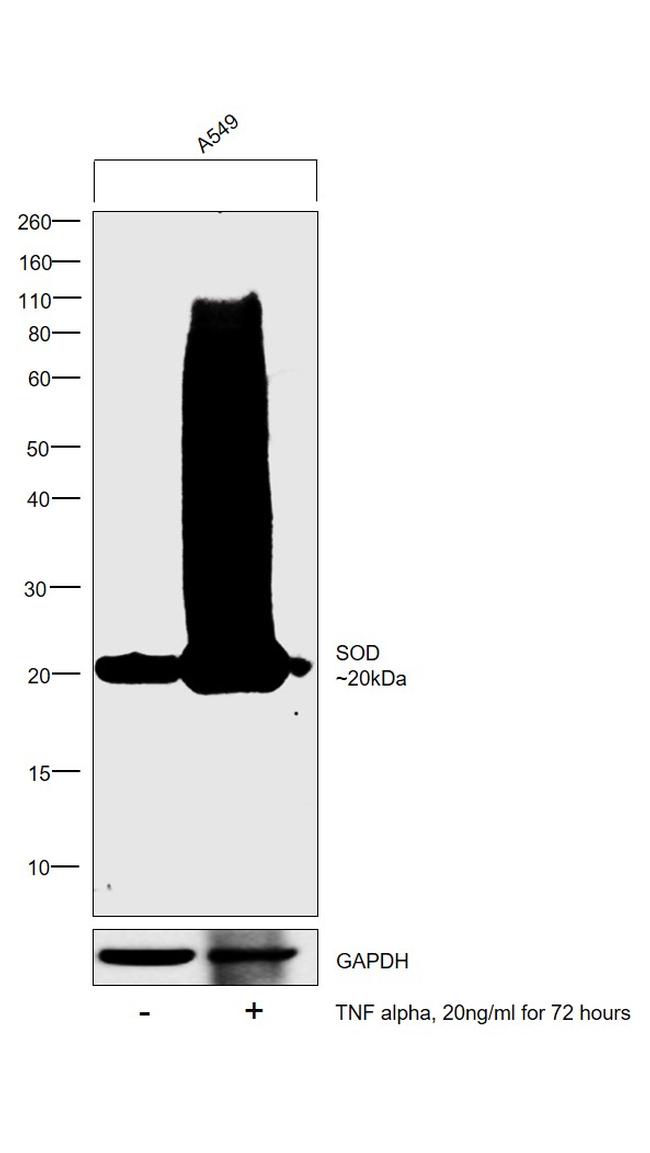 SOD2 Antibody