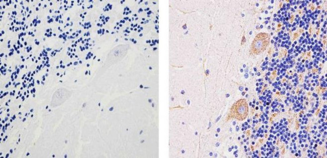 SOD2 Antibody in Immunohistochemistry (Paraffin) (IHC (P))