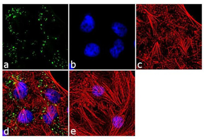 SOD2 Antibody in Immunocytochemistry (ICC/IF)