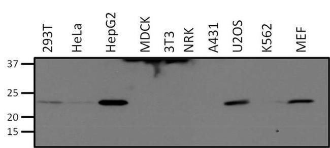 SOD2 Antibody in Western Blot (WB)