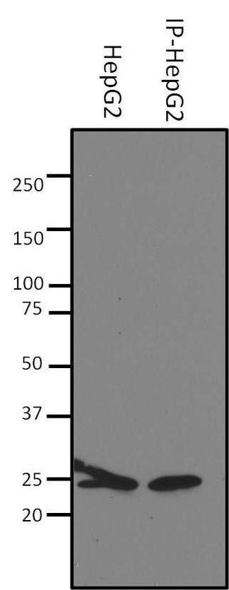 SOD2 Antibody in Immunoprecipitation (IP)