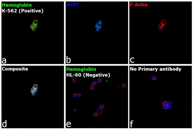 Hemoglobin Antibody in Immunocytochemistry (ICC/IF)
