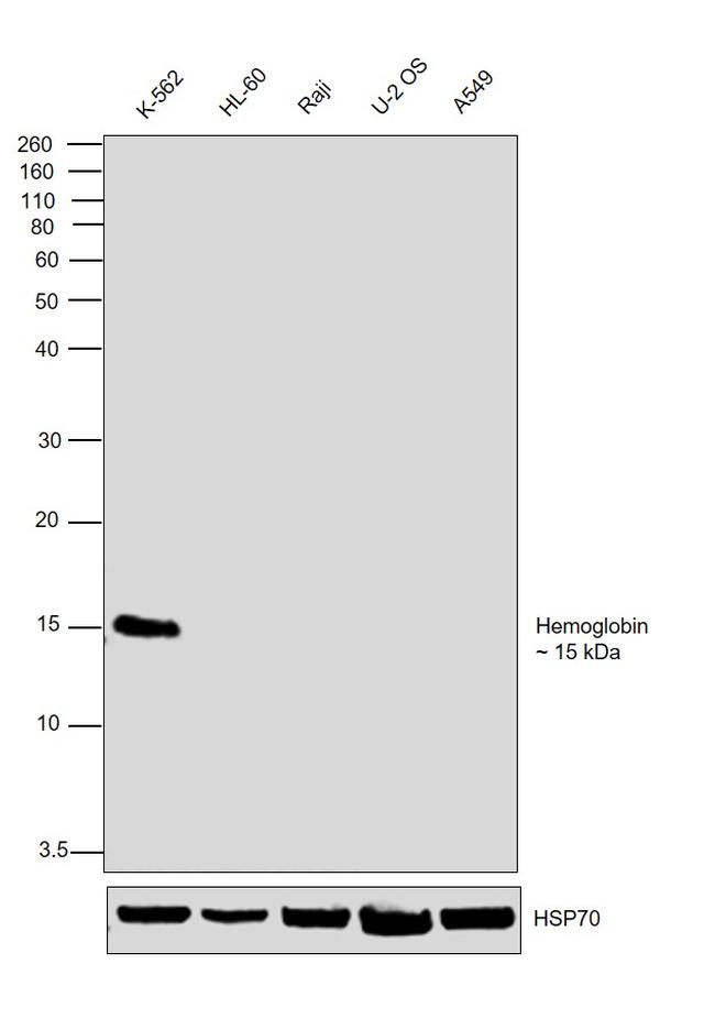 Hemoglobin Antibody in Western Blot (WB)