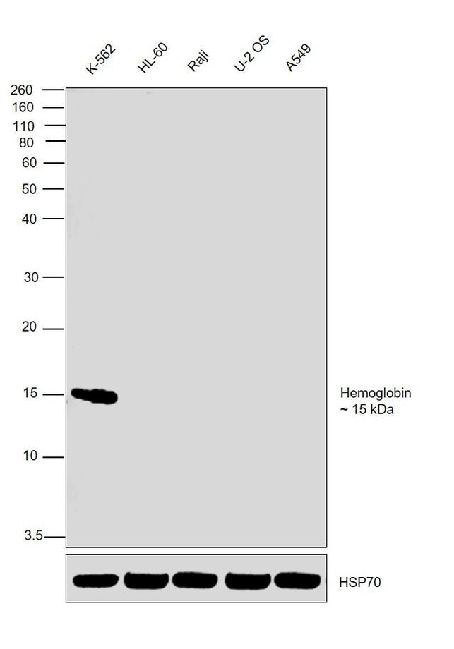 Hemoglobin Antibody