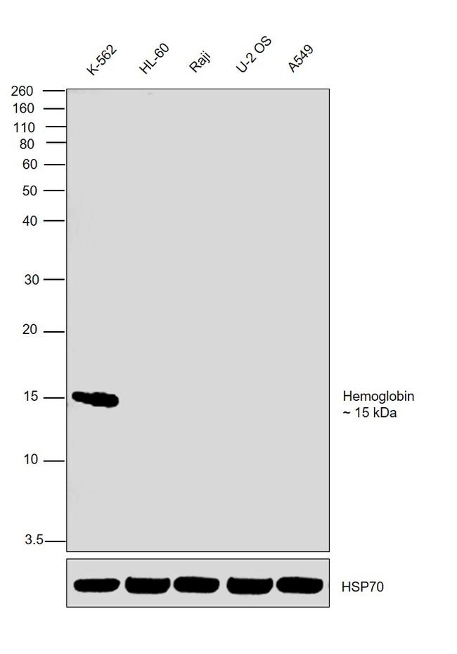 Hemoglobin Antibody in Western Blot (WB)