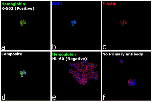 Hemoglobin Antibody in Immunocytochemistry (ICC/IF)