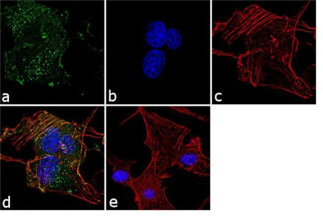 Huntingtin Antibody in Immunocytochemistry (ICC/IF)