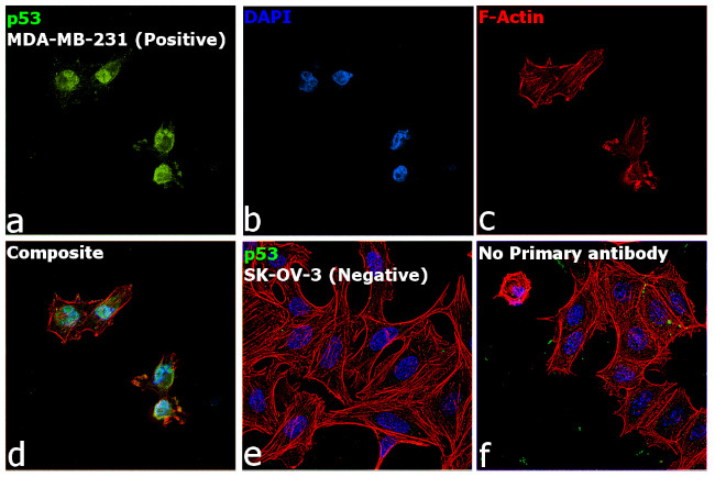 p53 Antibody in Immunocytochemistry (ICC/IF)