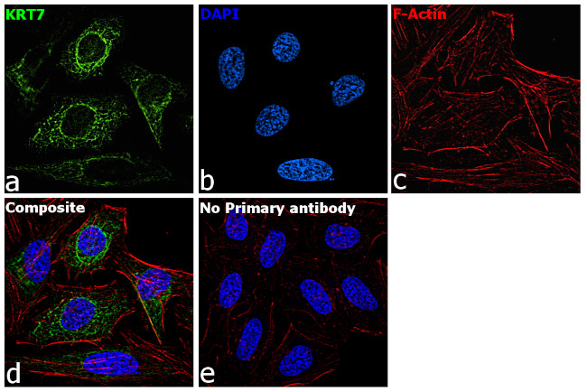 Cytokeratin 7 Antibody in Immunocytochemistry (ICC/IF)