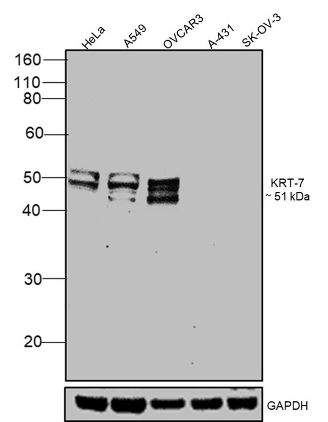 Cytokeratin 7 Antibody in Western Blot (WB)