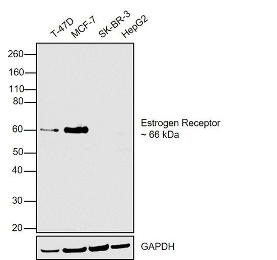 Estrogen Receptor alpha Antibody