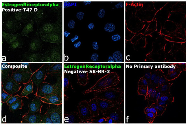 Estrogen Receptor alpha Antibody in Immunocytochemistry (ICC/IF)