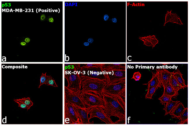 p53 Antibody in Immunocytochemistry (ICC/IF)