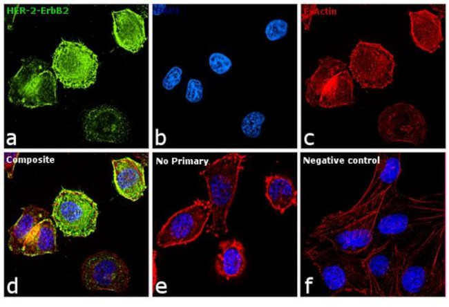 ErbB2 (HER-2) Antibody