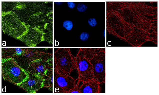 EGFR Antibody in Immunocytochemistry (ICC/IF)