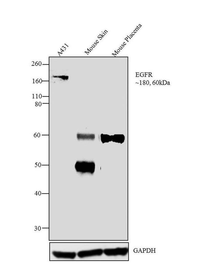 EGFR Antibody in Western Blot (WB)