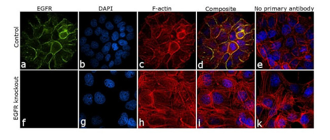 EGFR Antibody in Immunocytochemistry (ICC/IF)