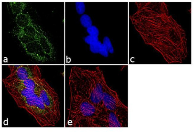 rRNA Antibody in Immunocytochemistry (ICC/IF)