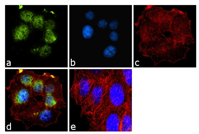 BRCA1 Antibody in Immunocytochemistry (ICC/IF)