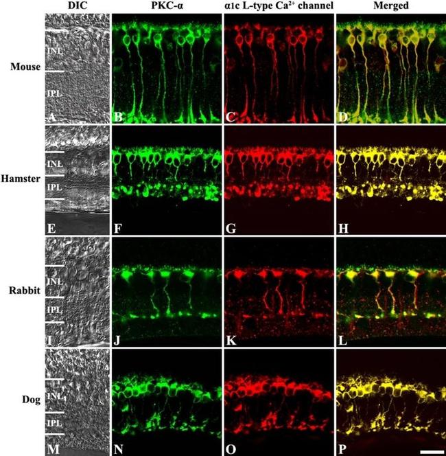 PKC alpha Antibody in Immunohistochemistry (IHC)