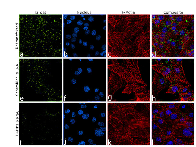 LAMP1 Antibody in Immunocytochemistry (ICC/IF)