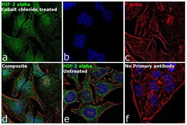 HIF-2 alpha Antibody