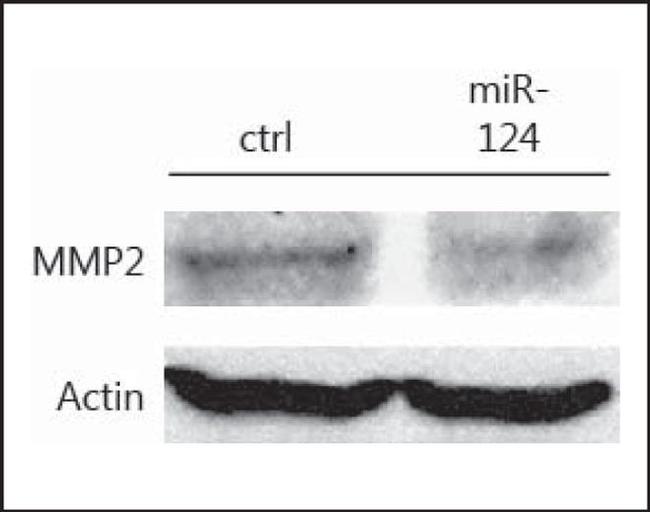 MMP2 Antibody in Western Blot (WB)